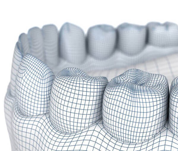 Machining Tooth Mold